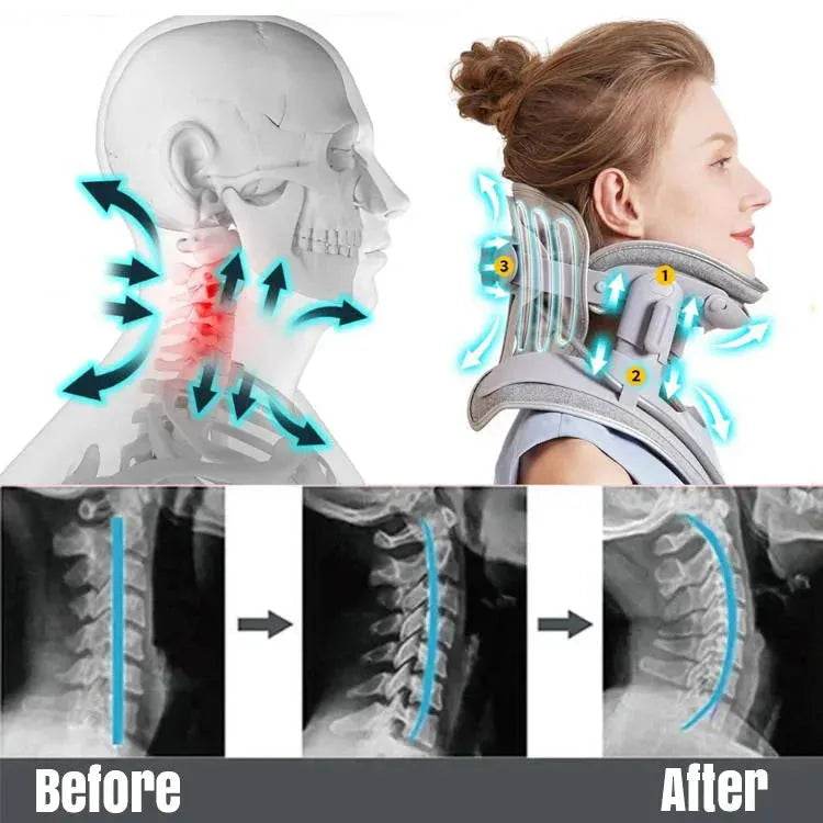 Cervical Traction Neck Brace Neck Traction Device - SmartPursue™